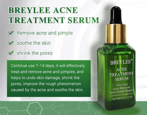 Serum Acne Treatment Facial